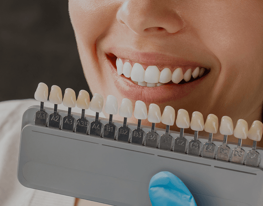 How Long Does Teeth Whitening Last?